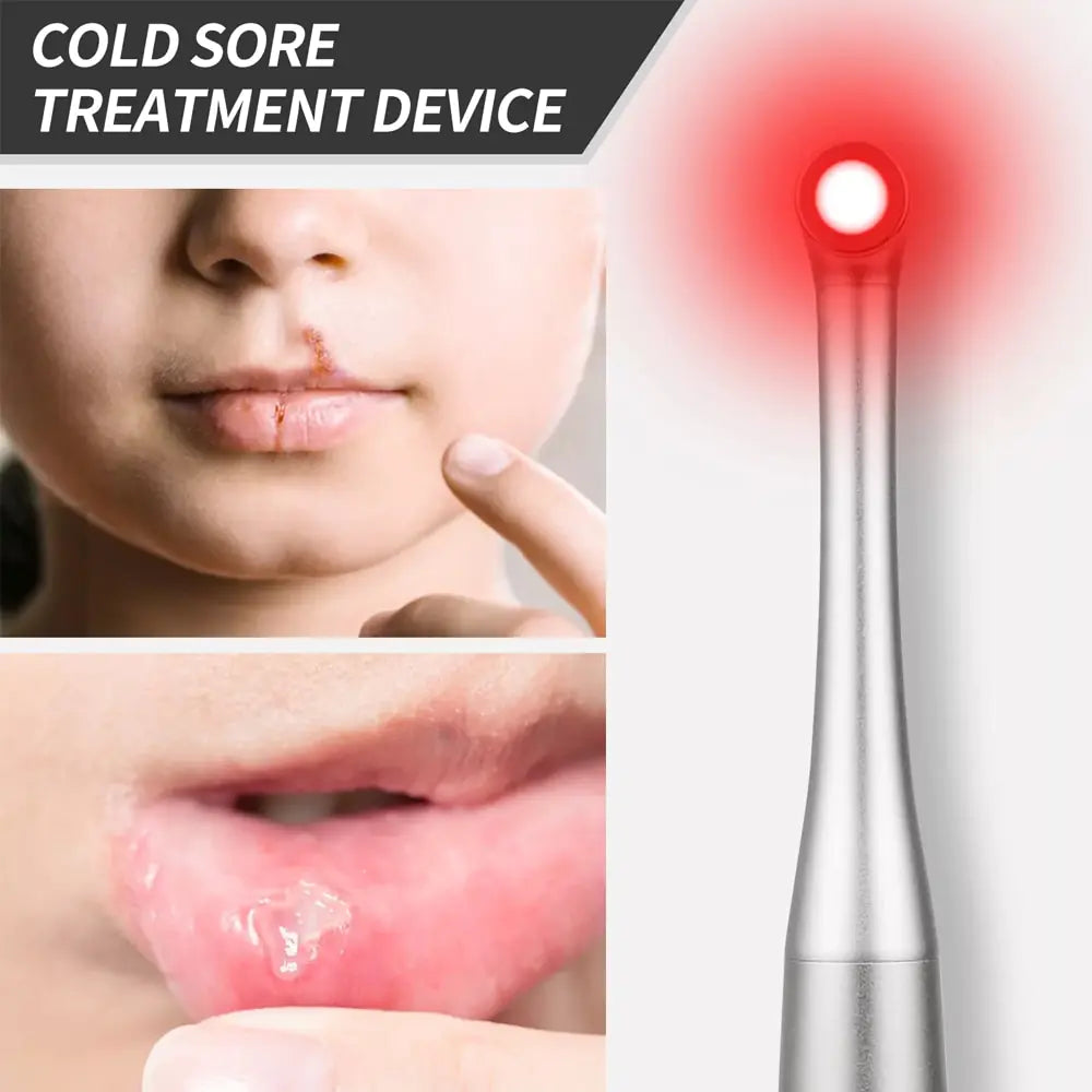 Red Light Therapy Cold Sore & Gums Wand Device