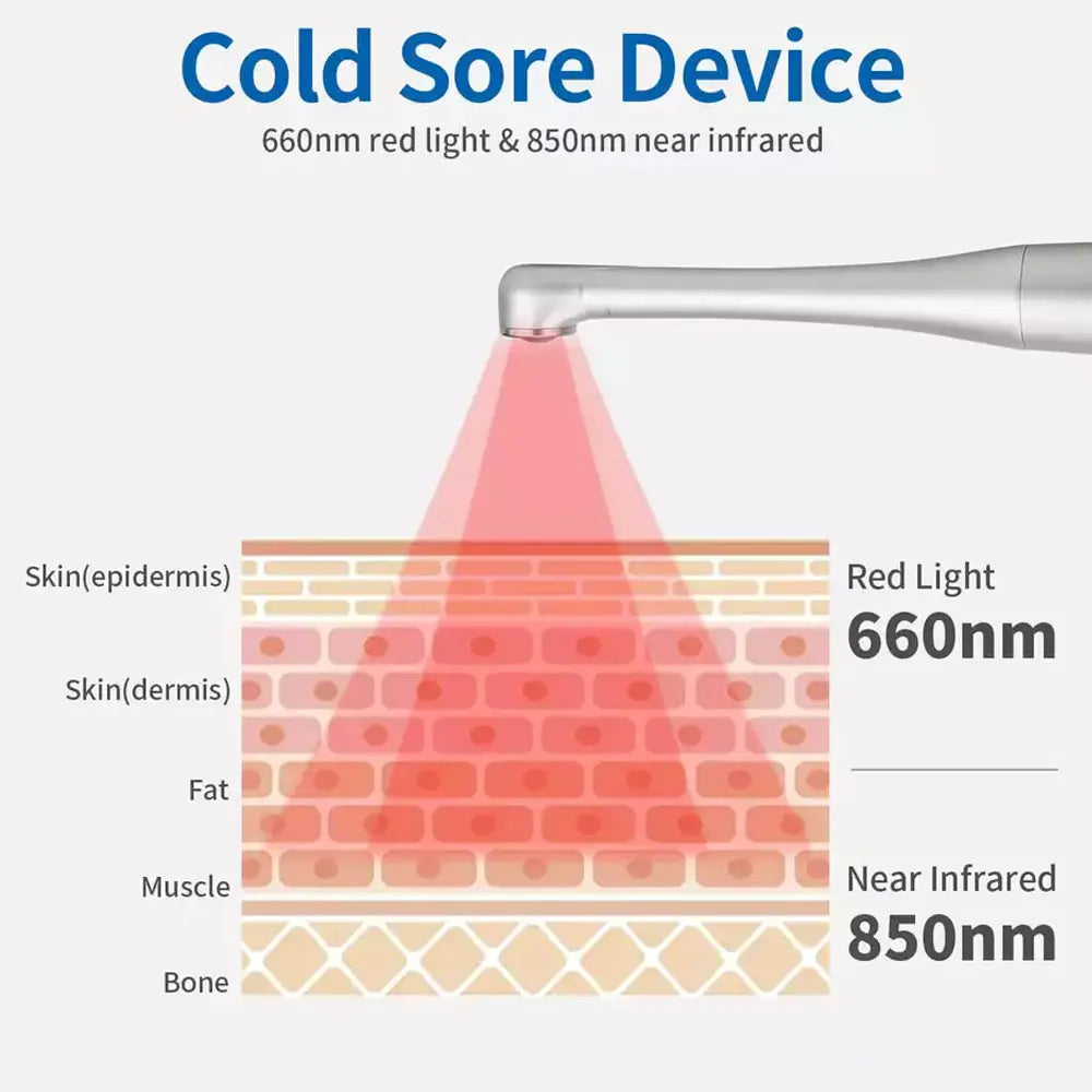 Red Light Therapy Cold Sore & Gums Wand Device